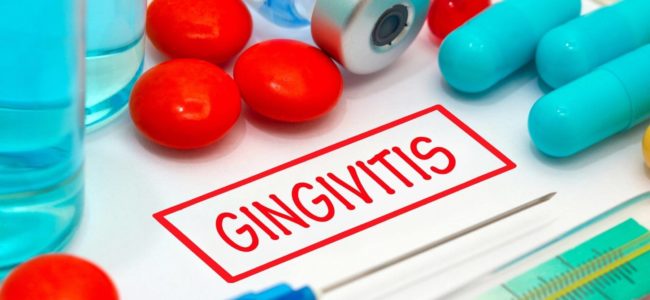 How Do You Fix Gingivitis?