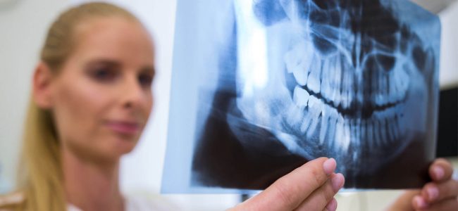 Why and How Often are X-Rays Necessary?