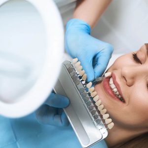 How to Care for Dental Veneers Portrait