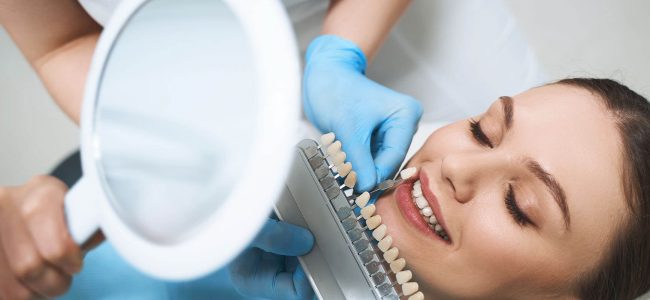 How to Care for Dental Veneers