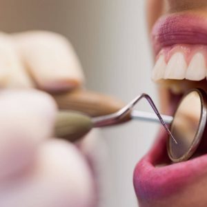 How Sugar Affects Your Teeth Portrait