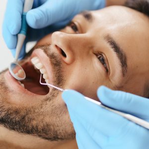 How to Prepare for a Dental Filling Portrait