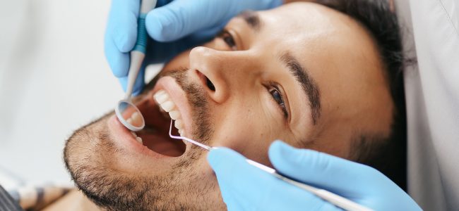 How to Prepare for a Dental Filling