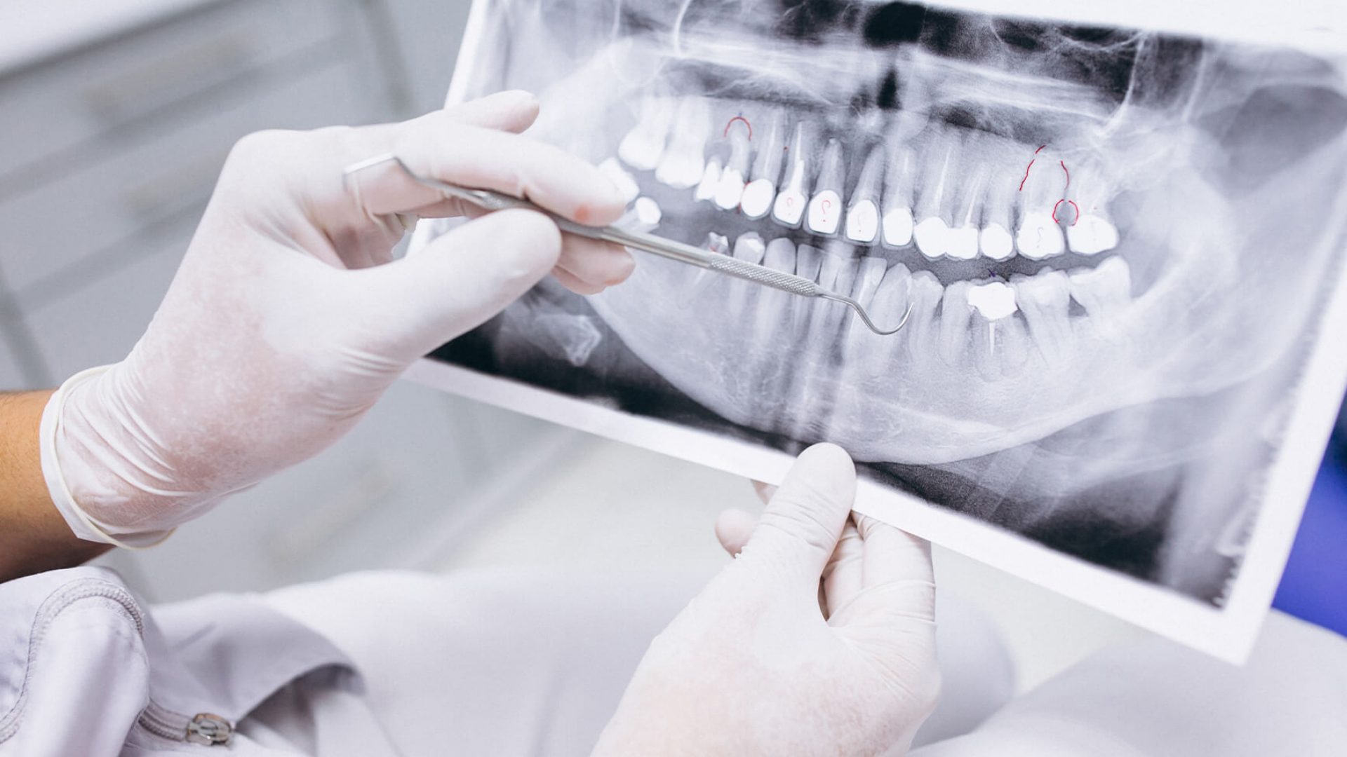 Ideal Dental Are Dental XRays Safe?