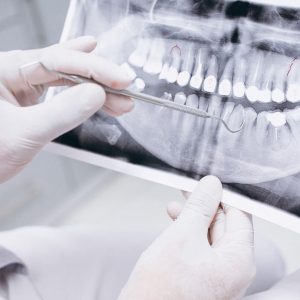 Are Dental X-Rays Safe? Portrait