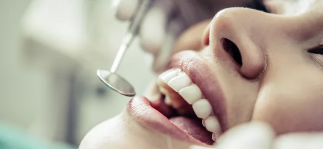 What to Expect When Getting a Dental Implant